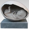 Foetus